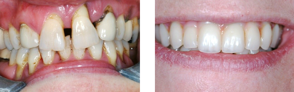 Dentist Marlborough